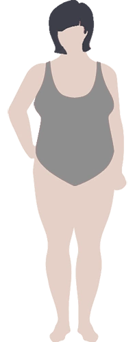 30–35 кг/м2