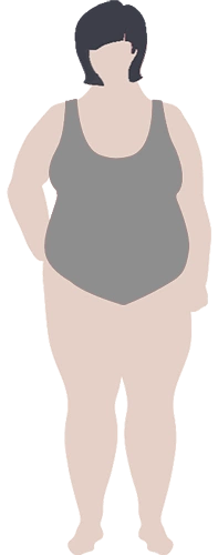 Больше 35 кг/м2